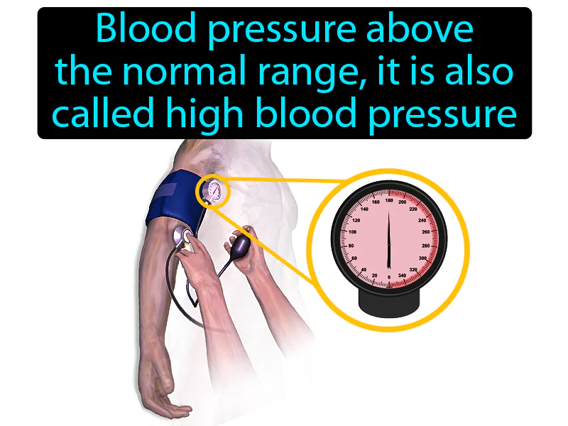 Hypertension Definition Hypertension Definition