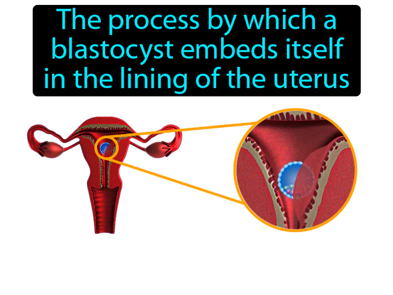 Implantation Definition Implantation Definition