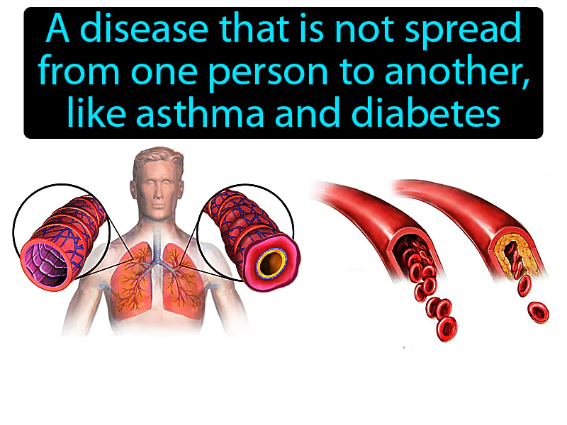 Noninfectious Disease Definition Noninfectious Disease Definition