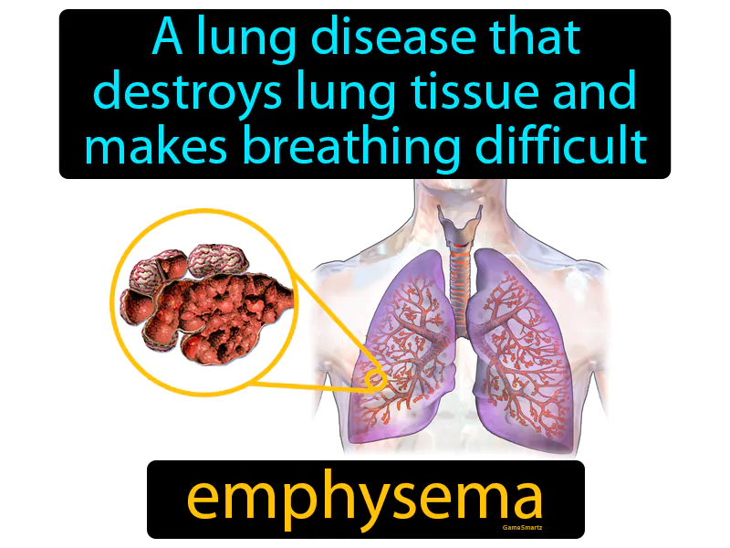 Emphysema Definition