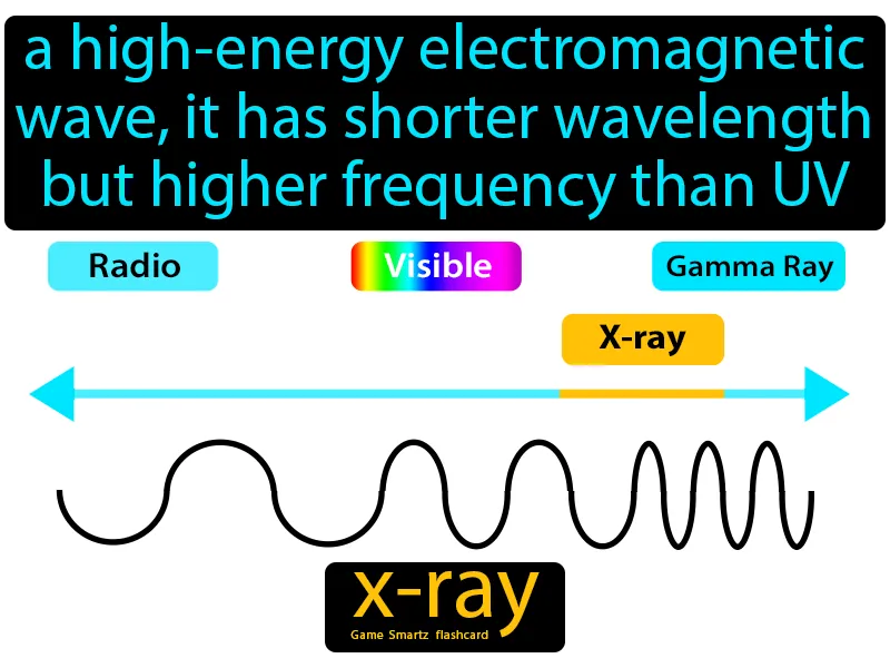 X-ray Definition X-ray Definition